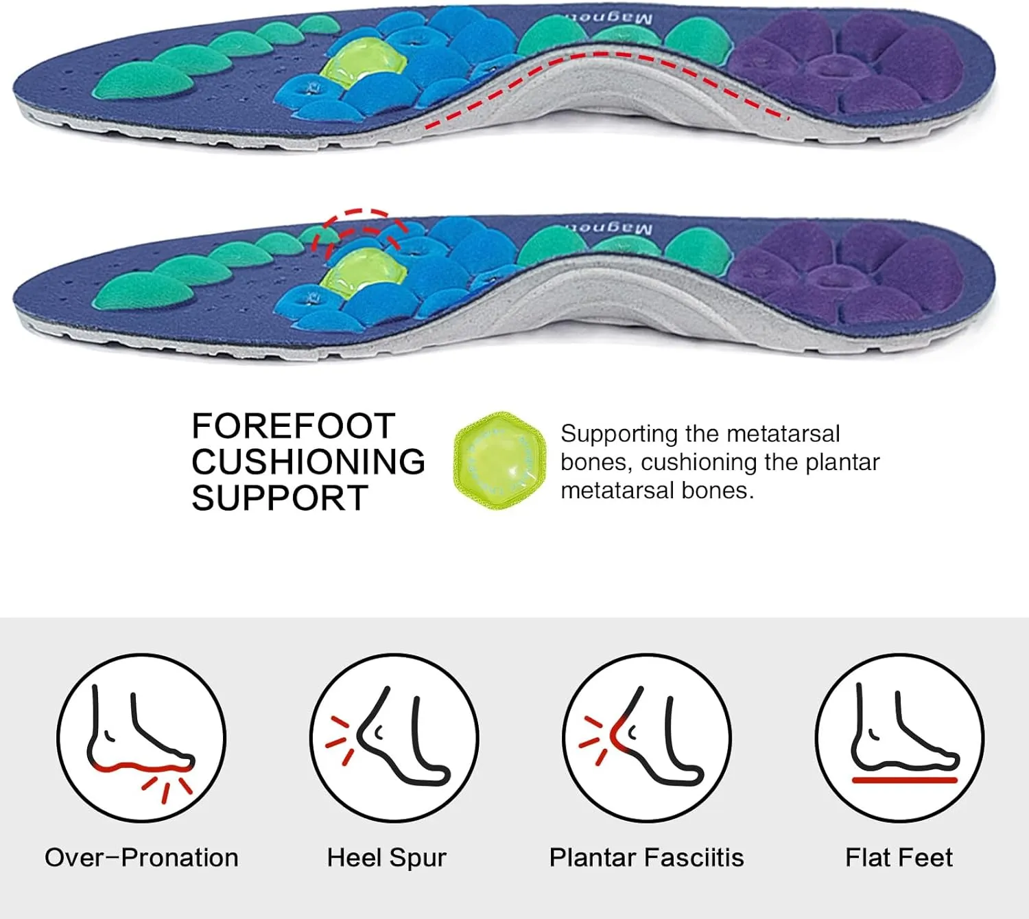Acupressure Insoles for Men and Women, Helps Promote Blood Circulation and Relieve Fatigue Orthopedic Acupoint Massage Insoles (Blue, S-US 4-7)