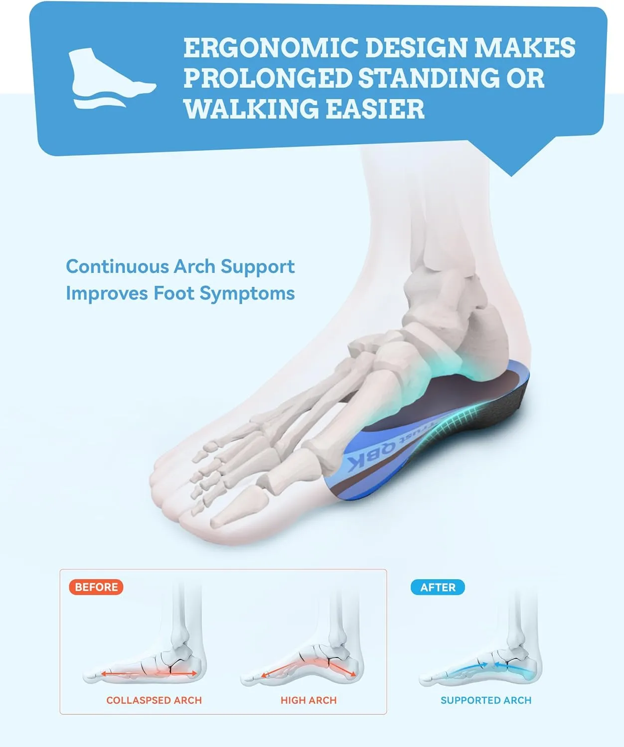 Arch Support Inserts, QBK Metatarsalgia Insoles, Men's Orthopedic Insoles, High Arch Support for Plantar Fasciitis, Flat Foot Metatarsal Bone Pain, Varus Foot XL