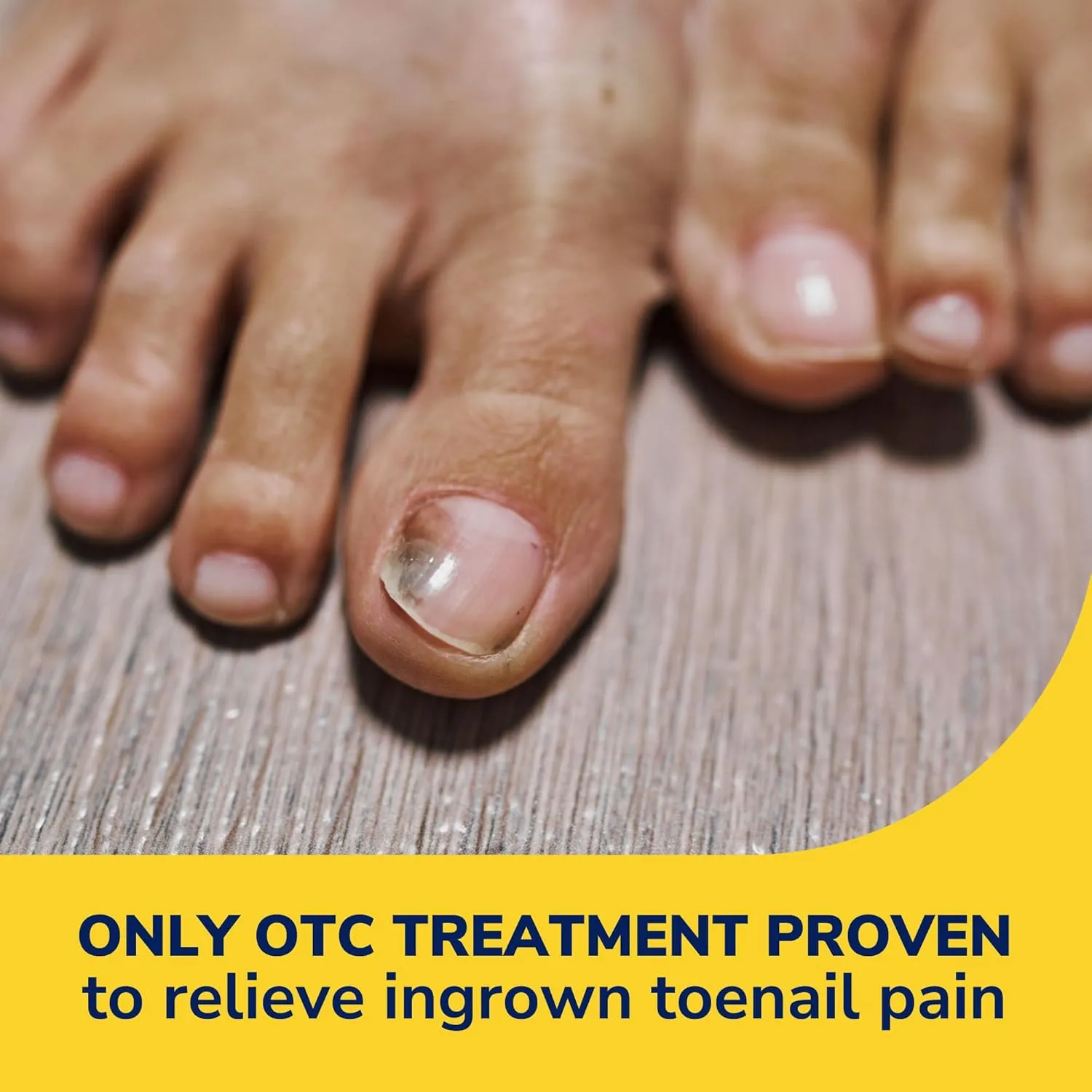 Dr. Scholl's INGROWN TOENAIL PAIN RELIEVER & TRIMMING KIT, 0.3 oz // Only OTC Treatment Proven to Relieve Ingrown Toenail Pain - Includes Medicated Gel   Foam Rings   Bandages   Clipper & Pusher Tools
