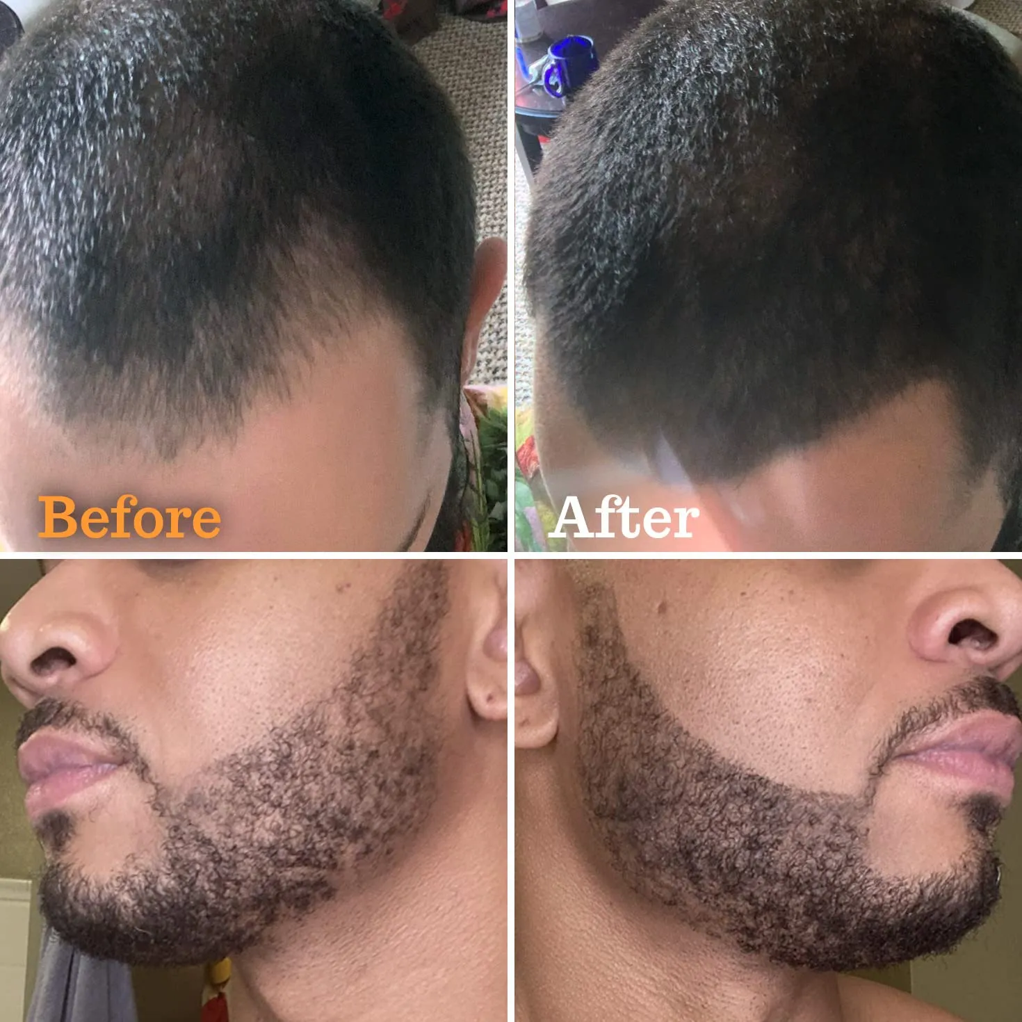 FOLLICLE BOOSTER Beard Pen Filler Styling Kit for Men - 3-in-1 Filling Set with 4-Tip Fork, Normal Pencil, and Brush - Waterproof, Sweatproof & All-Day Hold - Black