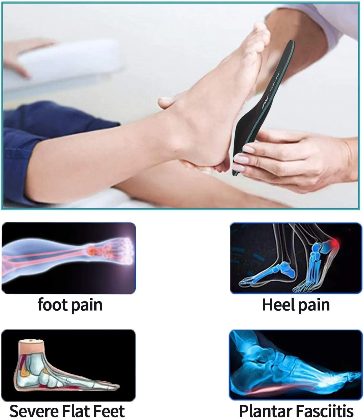 Severe Flat Feet Arch Support Insoles- Firm Arch Supports Orthotics Inserts Relieve Plantar Fasciitis, Over Pronation, Fallen Arch, Metatarsalgia, Foot Pain - Shoe Insoles for Men and Women
